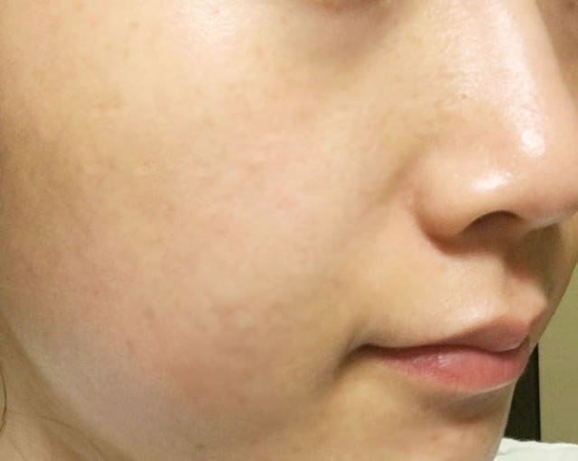 New ENCOS arbutin 5% whitening cream Visible funct