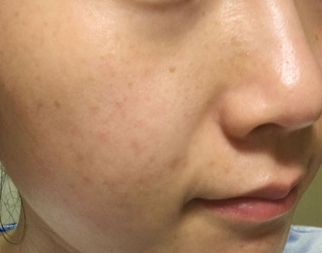 New ENCOS arbutin 5% whitening cream Visible funct