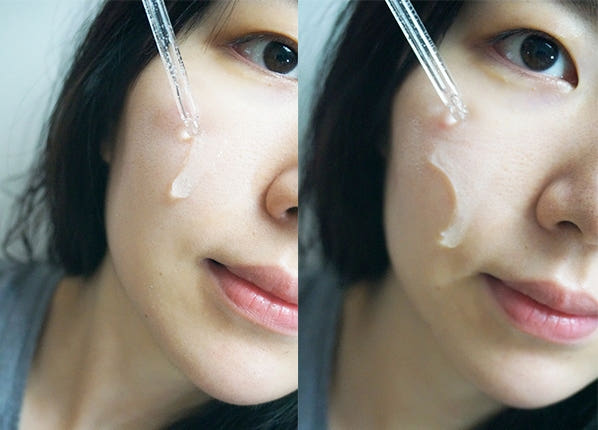 Pure Hills Sentela Ampel Essence Recommended Acne 