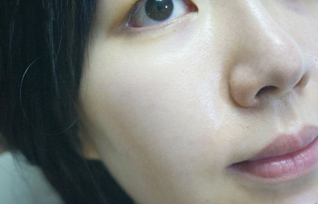 Pure Hills Sentela Ampel Essence Recommended Acne 