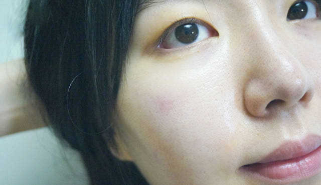 Pure Hills Sentela Ampel Essence Recommended Acne 