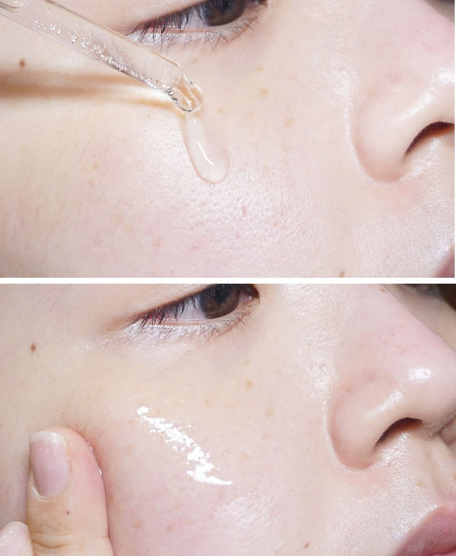 Pure Hills Sentela Ampel Essence Recommended Acne 