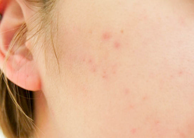 NEW SKIN MASQUE Arpefirst Two Trouble Patch Set Du