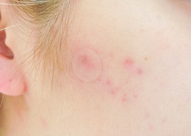 NEW SKIN MASQUE Arpefirst Two Trouble Patch Set Du