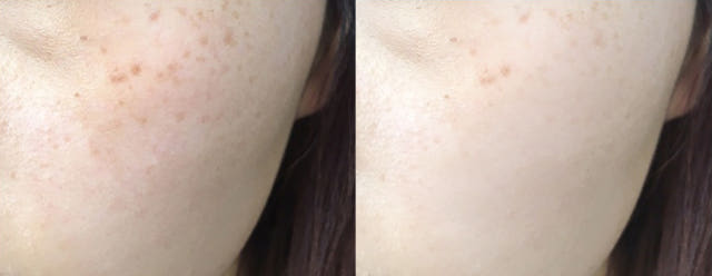 Deisel Encore Specials Dr. Vita Premium C Ampoules