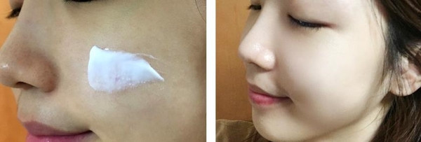 Dullness + pigmentation + under dark dark + darkne