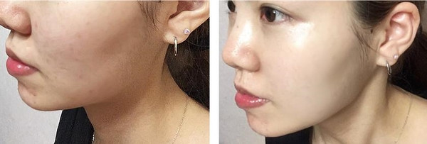 Dullness + pigmentation + under dark dark + darkne