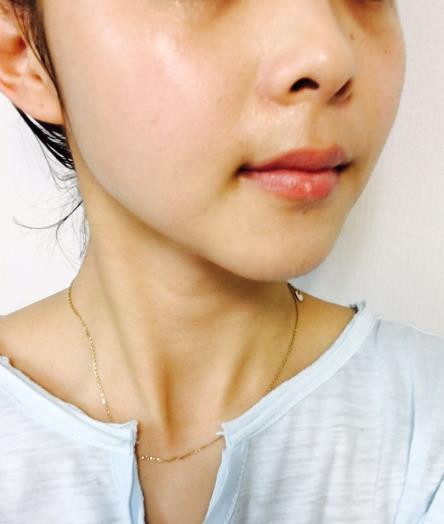 Dullness + pigmentation + under dark dark + darkne