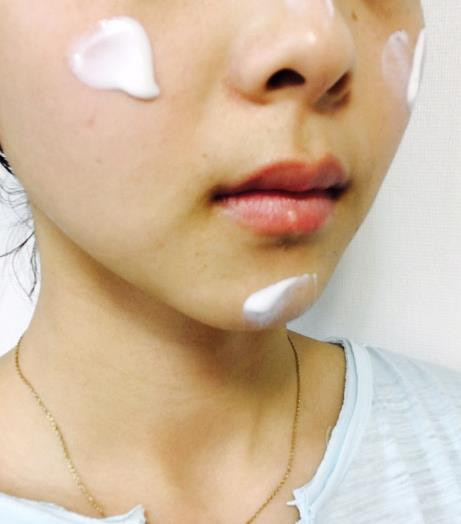 Dullness + pigmentation + under dark dark + darkne