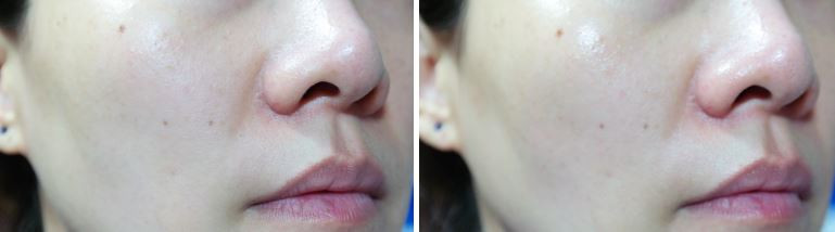 Pure Hills Propolis 90 Ampoules 50ml Essence Recom