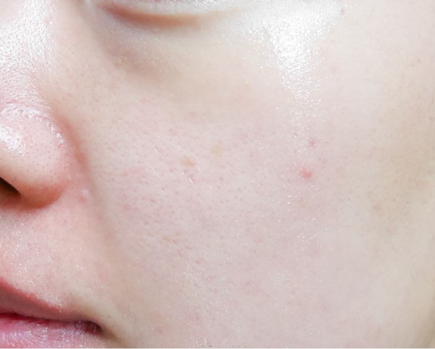 Tox and Fill Wrinkle Cover Ampoule 5ea Season 1 El