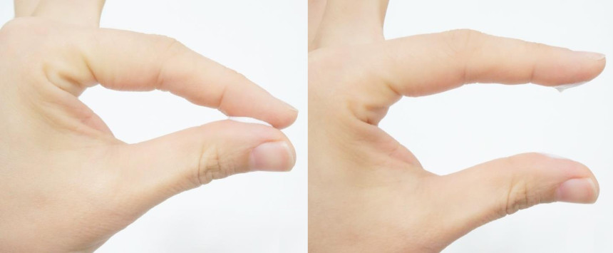 Dullness + pigmentation + under dark dark + darkne