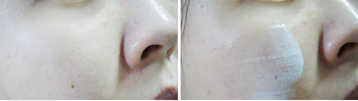 Dullness + pigmentation + under dark dark + darkne