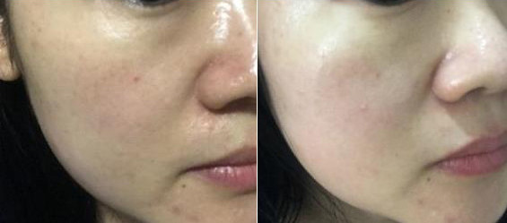 Dullness + pigmentation + under dark dark + darkne