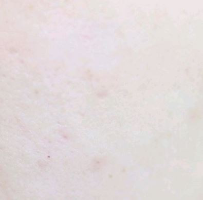 Addition of this product Ultra Vidévenon Ampou 2 p