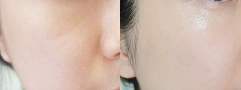 NEW SKIN MASQUE SNP Facial Pim Tension Mask Pack 5