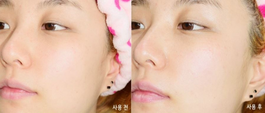 NEW SKIN MASQUE SNP Facial Pim Tension Mask Pack 5