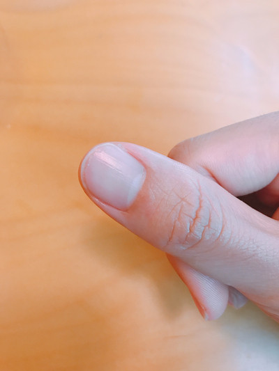 New Cellarilator Ointment Cream 30ml Skin Trail Im