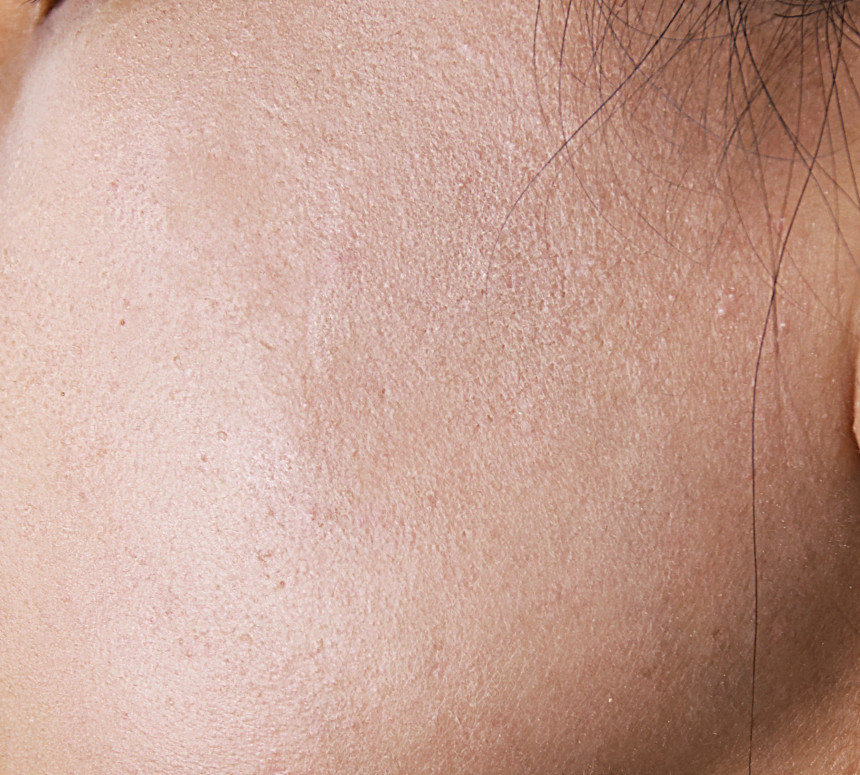 Deisel Encore Specials Dr. Vita Premium C Ampoules