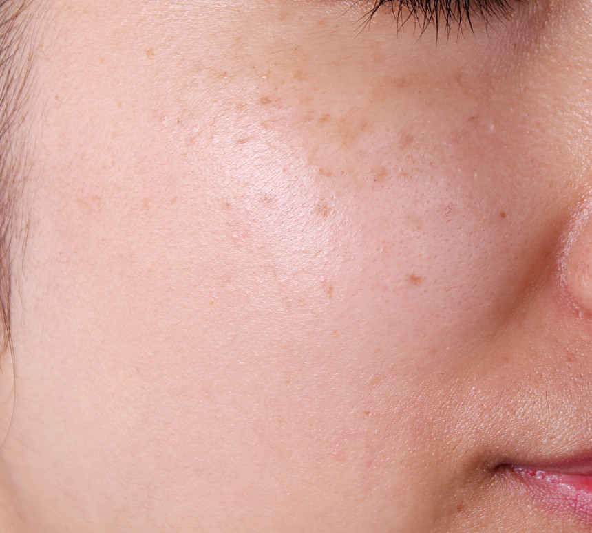 Deisel Encore Specials Dr. Vita Premium C Ampoules