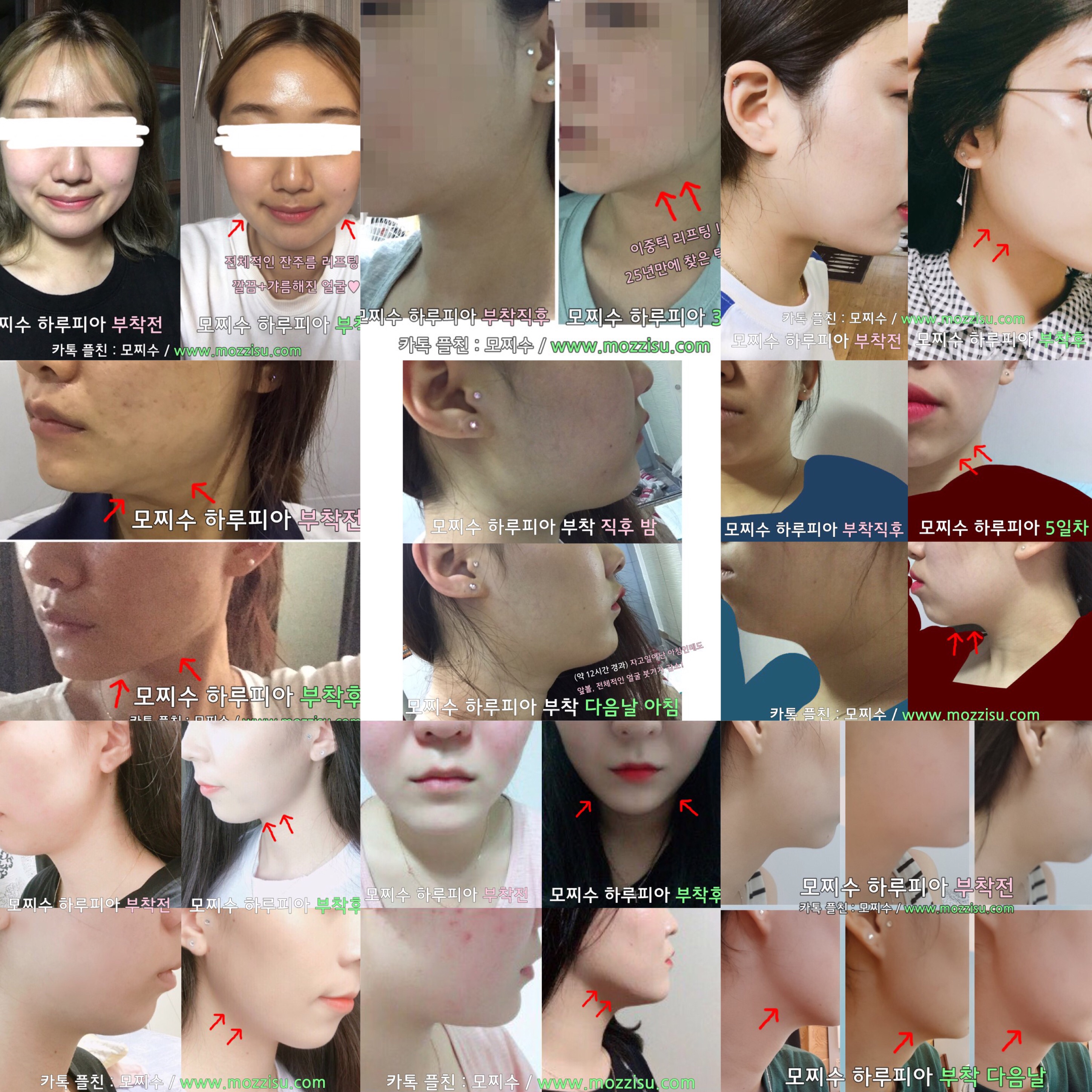 <b><p>Mochizu Day pia Genuine New concept Liftg</p></b><b><p>モチーフでき 一日ピア 本物 新概念 リフティングジュエリー 即時 効果 腫れ管理</p></b><br /><br /><p align='center'>