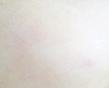 Dacelle Doctor Vita Premium 12 High Amount Ampoule