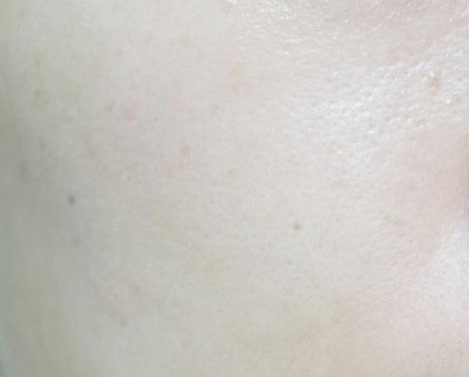 Dacelle Doctor Vita Premium 12 High Amount Ampoule