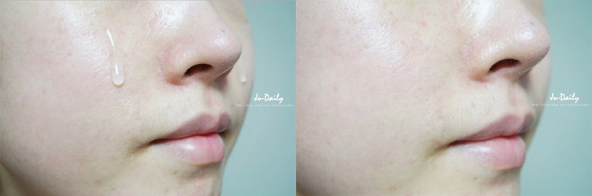 Greymelin Hyaluronic Acid 100 Serum 50ml Lonicic A