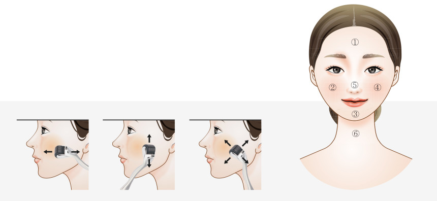 How to Reduce Acne Scarring Pores by Dr. Yu &amp M
