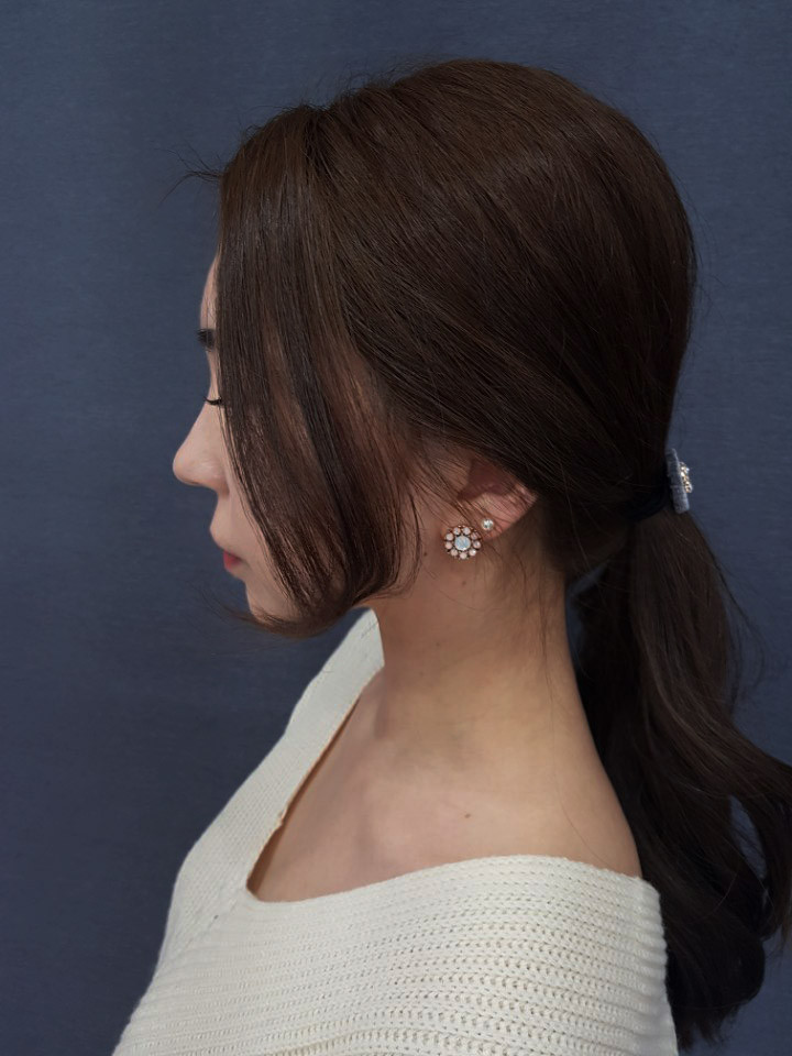 <b><p>Spring flowers 8 pieces set ear female Red</p></b><b><p>春の花 8ピース セット イヤリング 女性 洗練されたグリッター 高級アンティーク</p></b><br /><br /><p align='center'>