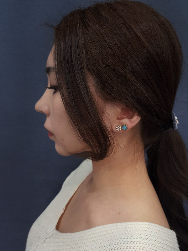 <b><p>Spring flowers 8 pieces set ear female Red</p></b><b><p>春の花 8ピース セット イヤリング 女性 洗練されたグリッター 高級アンティーク</p></b><br /><br /><p align='center'>