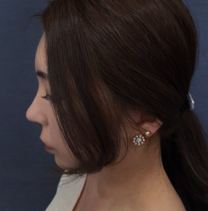 <b><p>Spring flowers 8 pieces set ear female Red</p></b><b><p>春の花 8ピース セット イヤリング 女性 洗練されたグリッター 高級アンティーク</p></b><br /><br /><p align='center'>