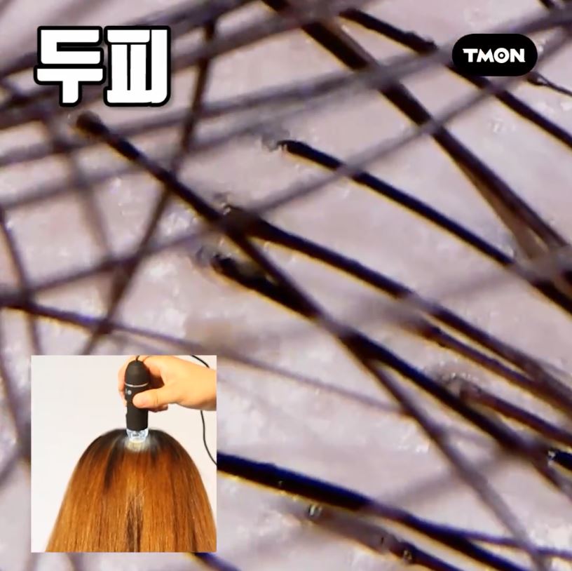 스마토이 전자 현미경 200배 USB 디지털 휴대용 스마트폰 현미경 - 상세 이미지 3