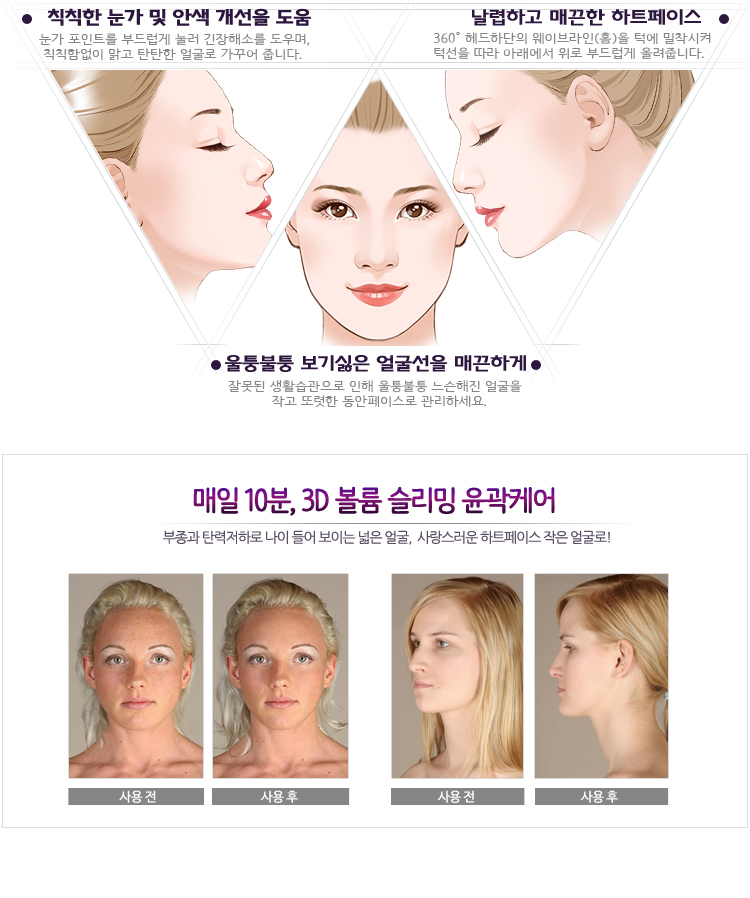 엔비테라피 이미지