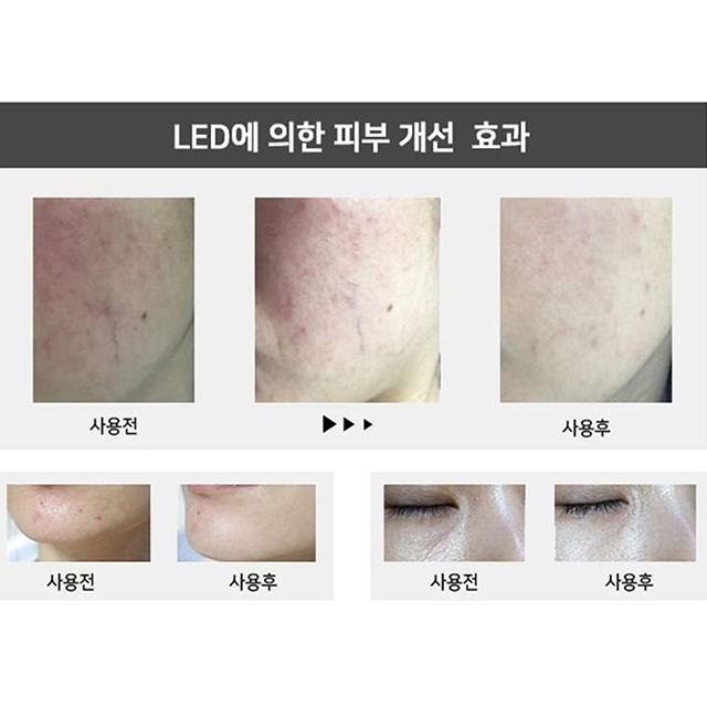 뷰티셀 에디션 2020 LED 고주파 진동 마사지기 안티에이징 화이트닝 트러블케어 리프팅 - 상세 이미지 3
