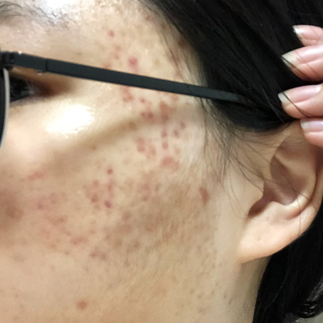 퓨어포레 센텔라 천연 병풀 스킨 모공 각질 수분 진정 대용량 시카토너패드 80매 판매처 상세 정보 이미지 2