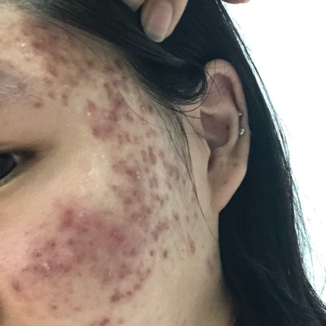 퓨어포레 센텔라 천연 병풀 스킨 모공 각질 수분 진정 대용량 시카토너패드 80매 판매처 상세 정보 이미지 1