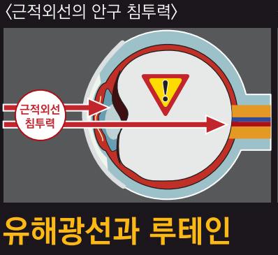 황반변성 의료기기안경 망막 시력보호안경 전자파 자외선 블루라이트 차단 누아크 G-03 - 상품 이미지