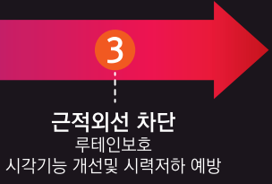 황반변성 의료기기안경 망막 시력보호안경 전자파 자외선 블루라이트 차단 누아크 G-03 - 상세 이미지 4