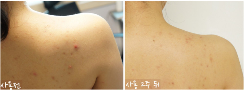 퓨어포레 센텔라 초등학생 어린이 키즈 순한 보습 진정 비건 사카바디로션 250ml 판매처 상세 정보 이미지 1