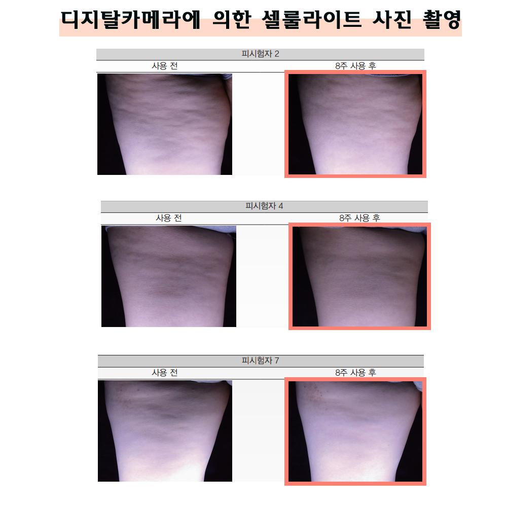 PPC 괄사 마사지기 허벅지 크림 뱃살 이중턱 바디슬리밍 크림 로션 - 상세 이미지 2