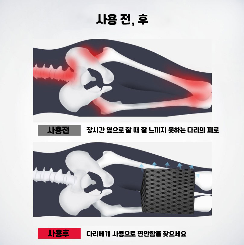 더나은 메쉬 다리 베개 산모선물 쿠션 종아리 허벅지 수면 숙면 자세교정