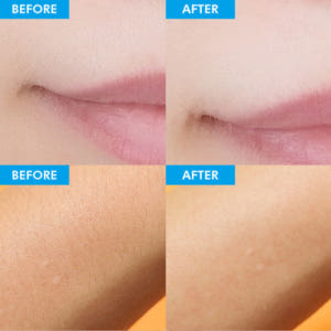 텐미닛 제모크림 겨드랑이 여자 인중제모 똥꼬털 겨털 남자 다리털 종아리 ... 솔직 후기 | 피부 타입별 분석 - 상품 이미지 4