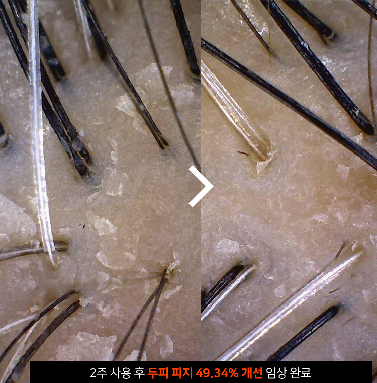 닥터올가 태초 다시마 탈모 증상 완화 샴푸 500ml x 2개 - 상세 이미지 2
