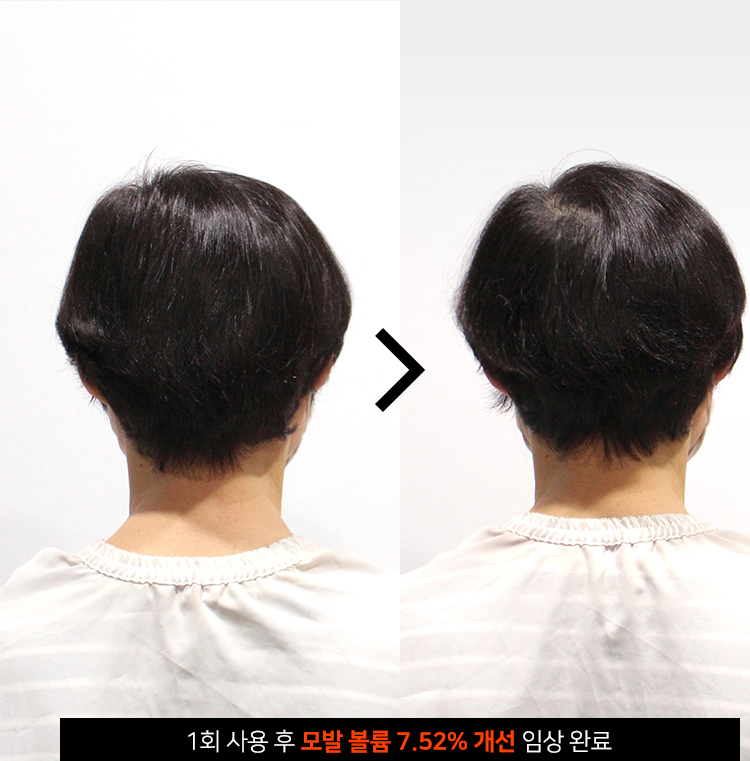 닥터올가 태초 다시마 탈모 증상 완화 샴푸 500ml x 2개 - 상세 이미지 5