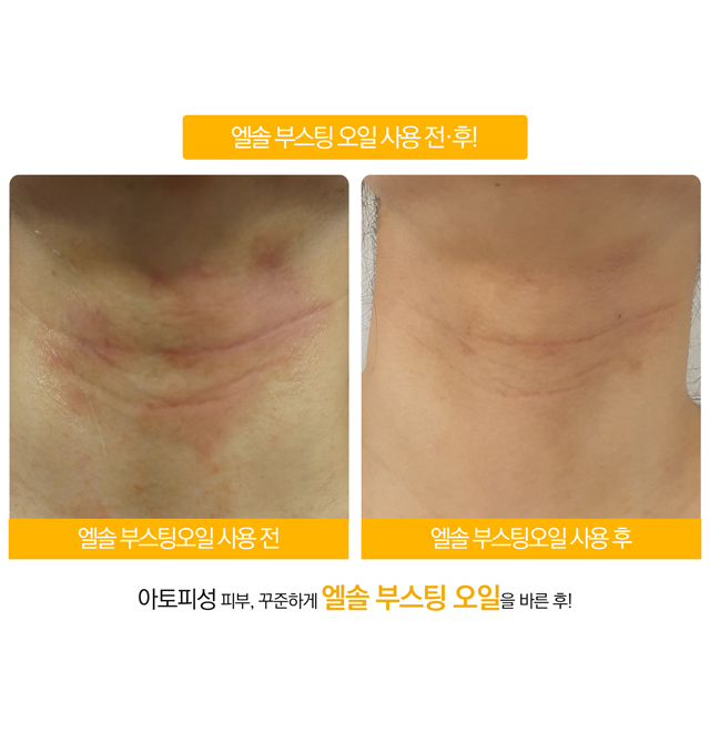 상떼 엘솔 부스팅 오일 50ml 100% 천연호호바오일 - 상세 이미지 3