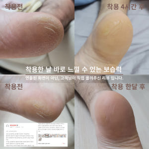 보스비 [풋캡] 보습 풋패드 발뒤꿈치 발꿈치 발바닥 통증 갈라짐 실사용 후기 | 효과 있을까? - 상품 이미지 4