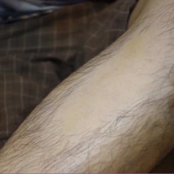 셀프왁싱 종아리 겨드랑이 남자 다리털 수염 가슴털 제모 왁싱 크림 하드타입 250g - 상세 이미지 5