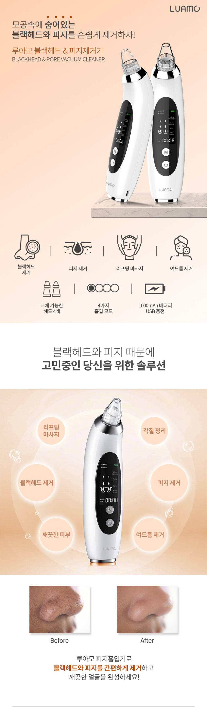 루아모 진공 블랙헤드 제거 피지흡입기 판매처 상세 정보 이미지 1