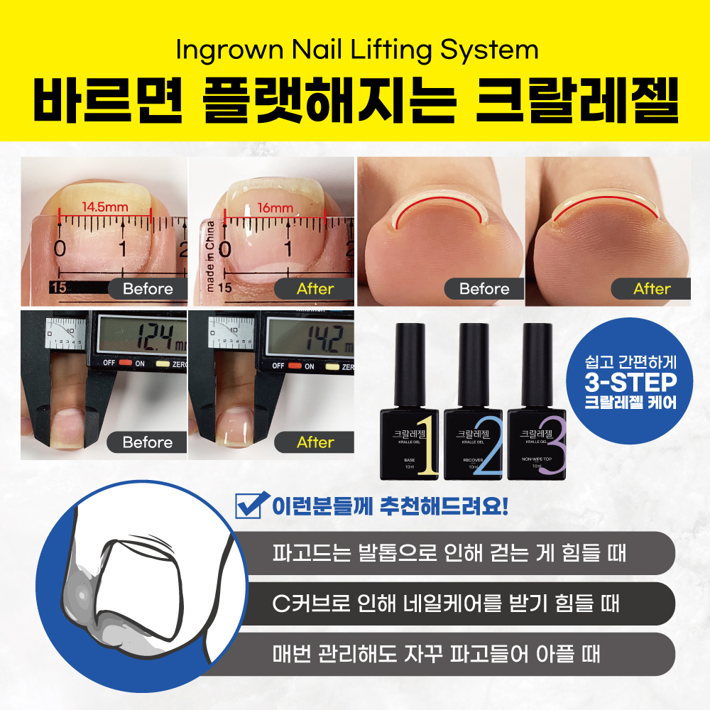 바르면 펴지는 크랄레젤 플랫 베이스젤 발톱 레진젤 발톱관리 - 상세 이미지 5